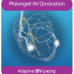 Advance Technology in Cardiac Resynchronization Therapy (CRT)